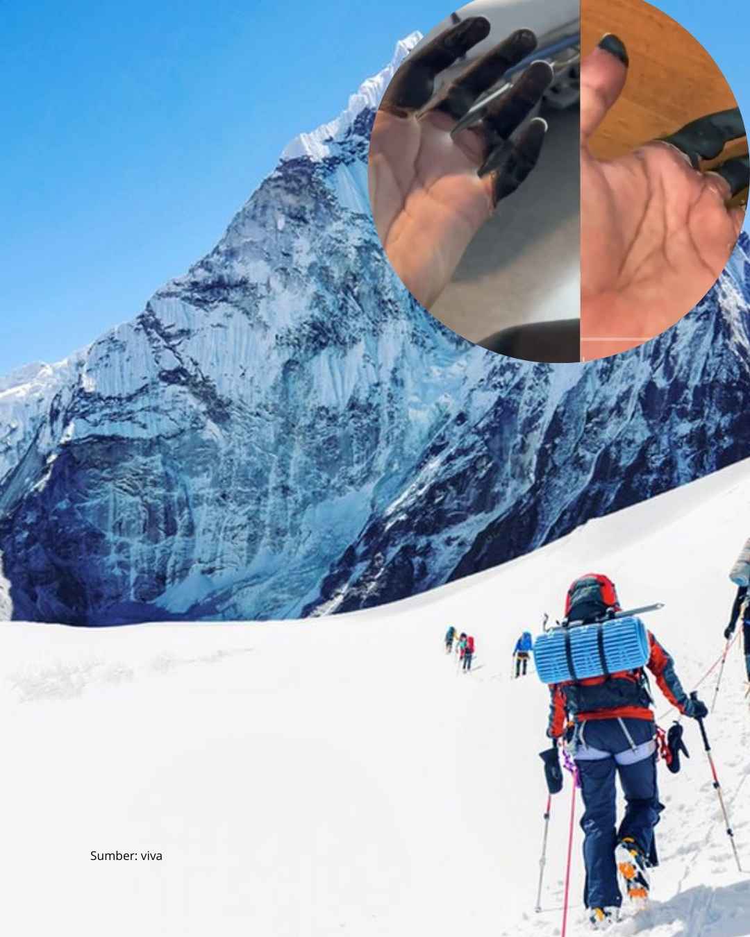 Kisah Fahad jadi pengingat pentingnya oksigen suplemen di atas 8.000 mdpl
