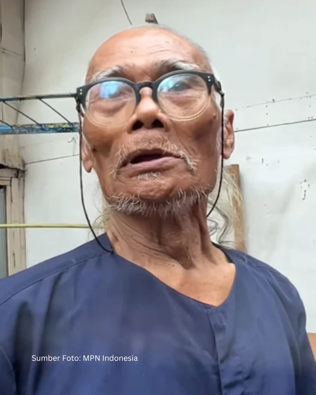 Legenda Warkop DKI, Kini Berjuang di Usia Senja