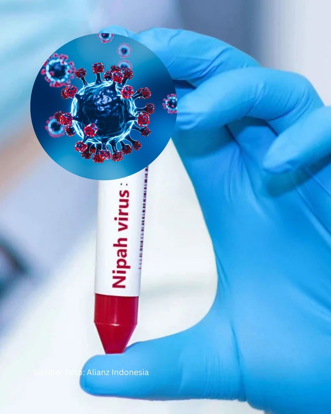 Dunia Siaga! WHO Tetapkan Virus Nipah Sebagai Patogen Prioritas Usai Temuan Kasus Baru