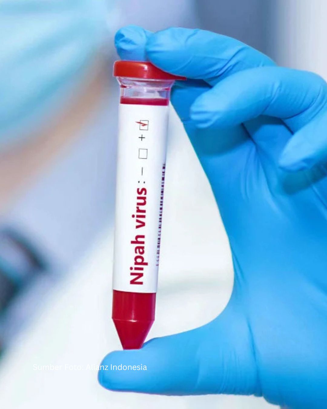Dunia Siaga! WHO Tetapkan Virus Nipah Sebagai Patogen Prioritas Usai Temuan Kasus Baru
