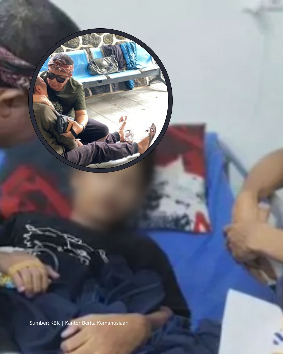 Ibu Tiri Menganiaya Anak, Tubuh Melepuh, Paru Bengkak di Beri Minum Air Panas Sampai Meninggal